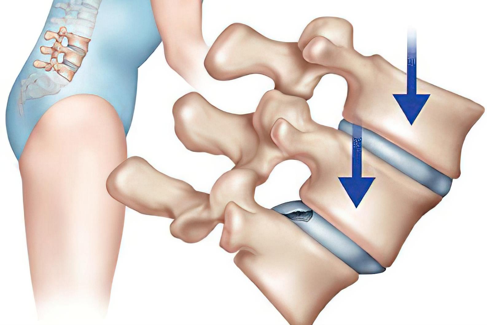 调整坐的姿势改善驼背,调整坐姿走姿让腿越来越直