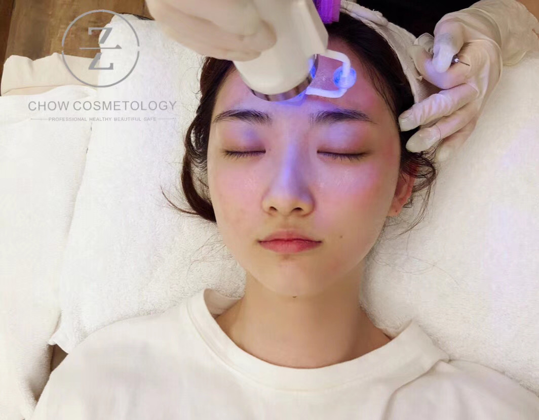 冻龄皮肤的秘诀,皮肤测试科学护肤