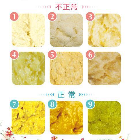 宝宝大便小妙招5分钟见效,宝宝便便教学