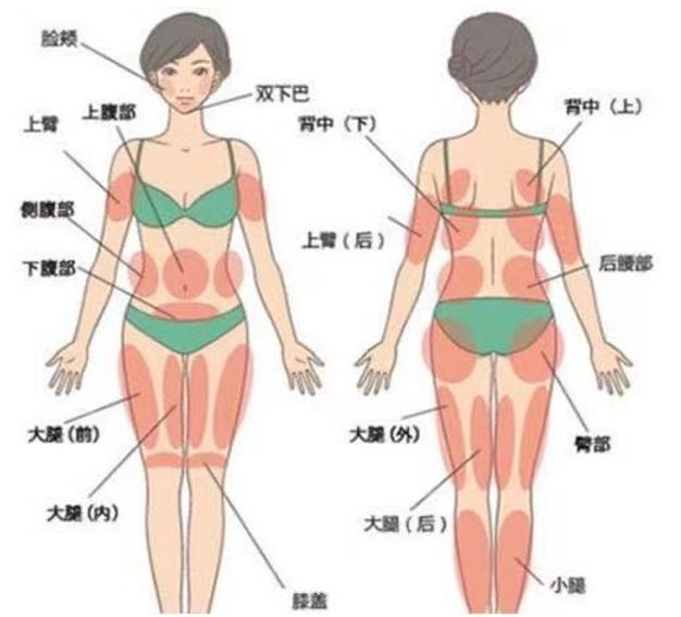 女子抽脂手术后续,女子抽脂突然没了呼吸心跳