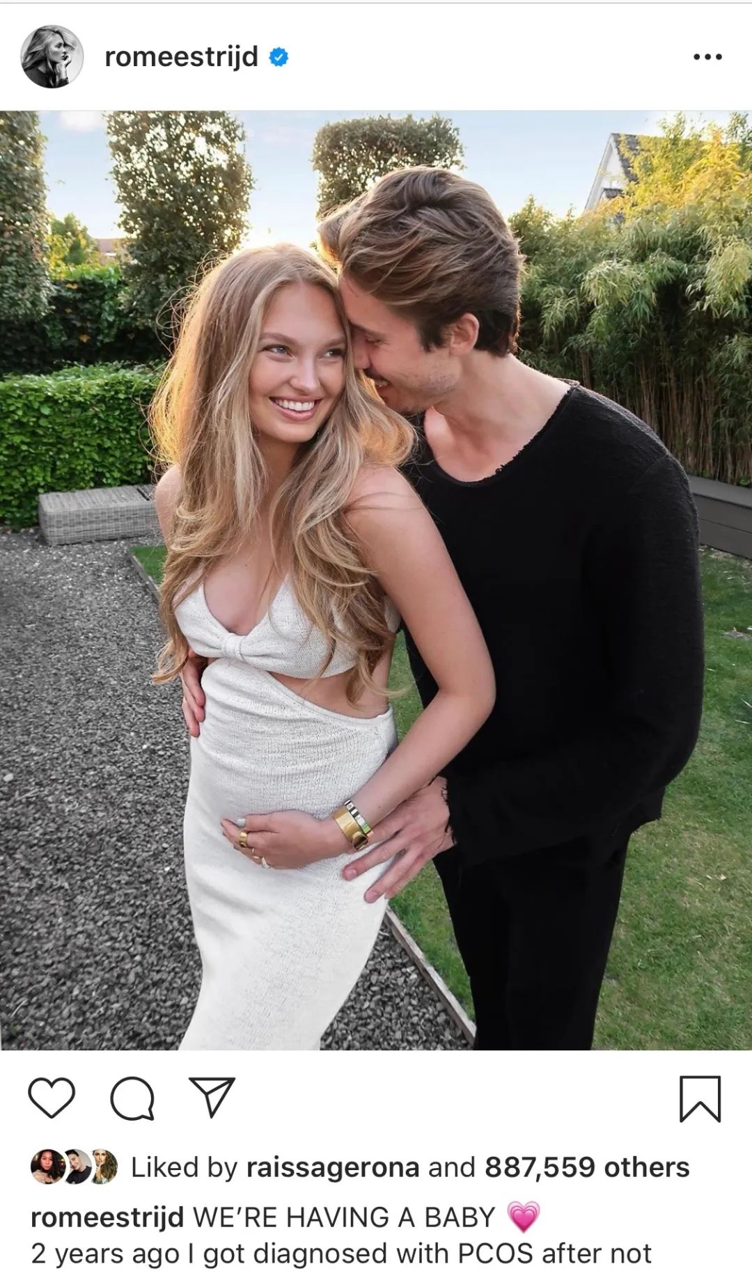 维密超模不为人知的秘密,维密模特养颜秘诀