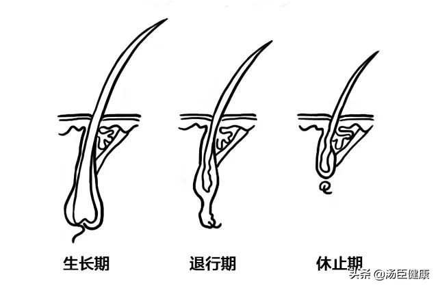 其它地方的毛发可以移植到头上吗,身上的毛可以移植到头发上吗