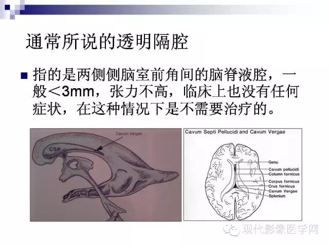 成年人透明隔腔增宽能活多久,透明隔缺如临床意义