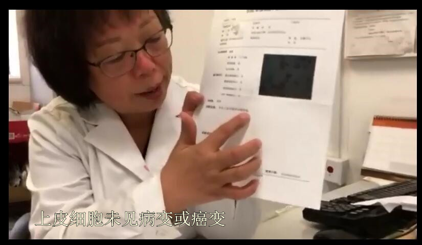 宫颈癌筛查tct轻度炎症严重吗,宫颈癌tct检查有炎症hpv16阳性