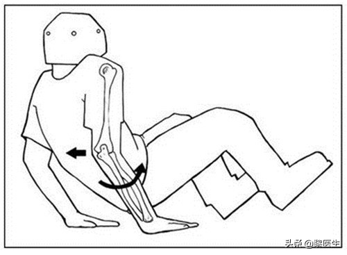 肘关节脱位x片都可以看出来吗,肘关节后脱位的特征表现是什么