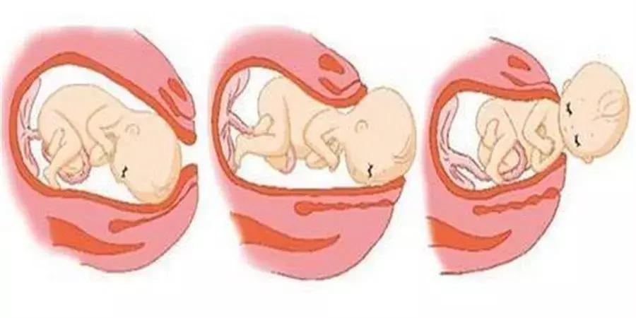 34周感觉有入盆的症状正常吗,宝宝入盆的时候会有什么症状