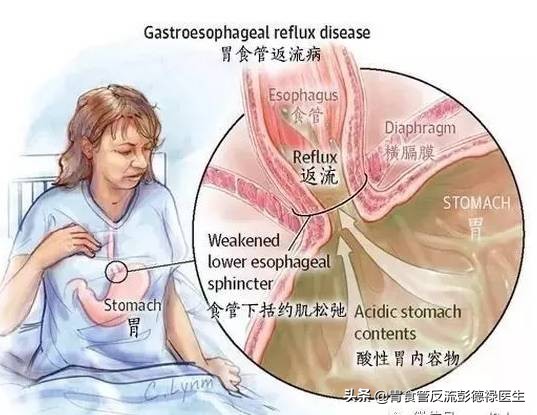 晚饭吃多了半夜胃难受怎么办,晚饭吃多了后到半夜就胃不舒服