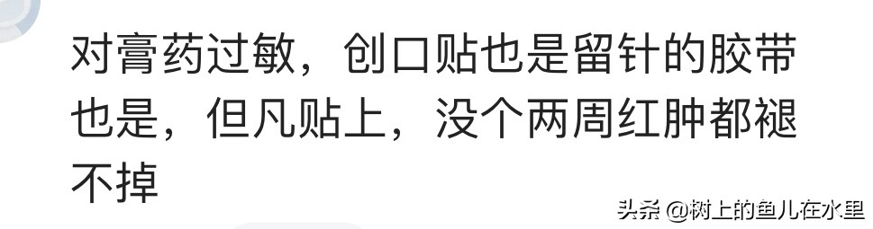 你身边有哪些特殊的体质？网友：我对自己的头发过敏