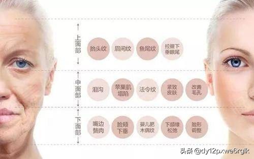 线雕与拉皮哪个除皱效果好,皮肤下垂做拉皮好还是线雕好