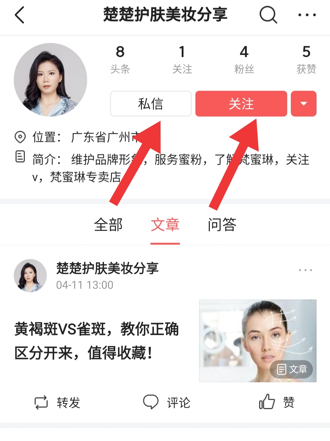 为什么会出现泪沟有什么改善方法,眼下泪沟怎么消除