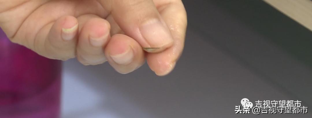 “睡梦中治近视”，受追捧的角膜塑形镜真有用吗？