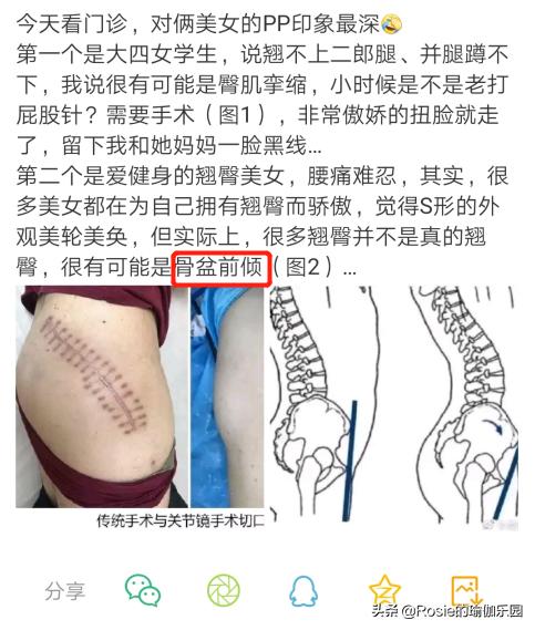 真翘臀和假翘臀怎么辨别,怎样判断翘臀是不是假的