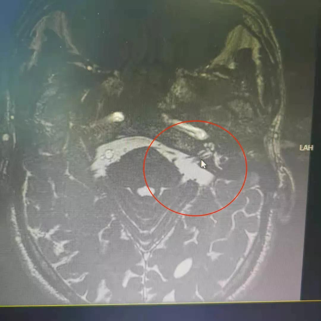 天下第一痛,什么是天下第一痛