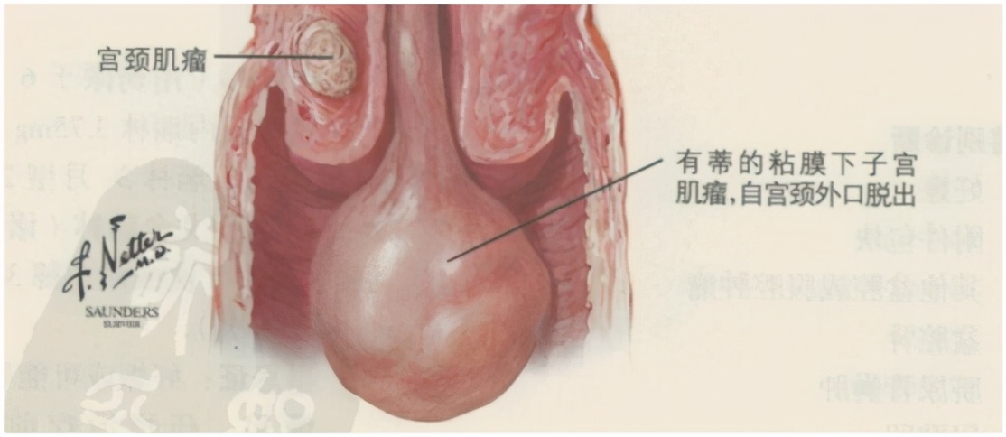 生理活动后第二天少量出血,内裤有少量血是怎么回事
