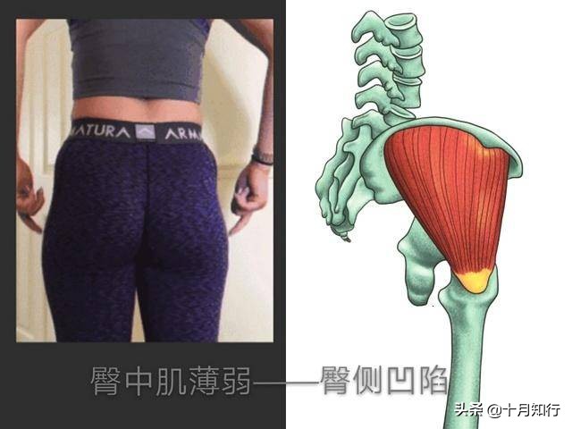 臀凹陷练臀中肌前束还是后束,锻炼臀肌最有效的方法
