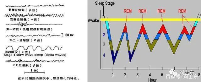 脑电图基础知识入门,脑电图基础知识讲解