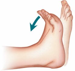 跑步足底痛的防治,足底跑步疼是什么症状