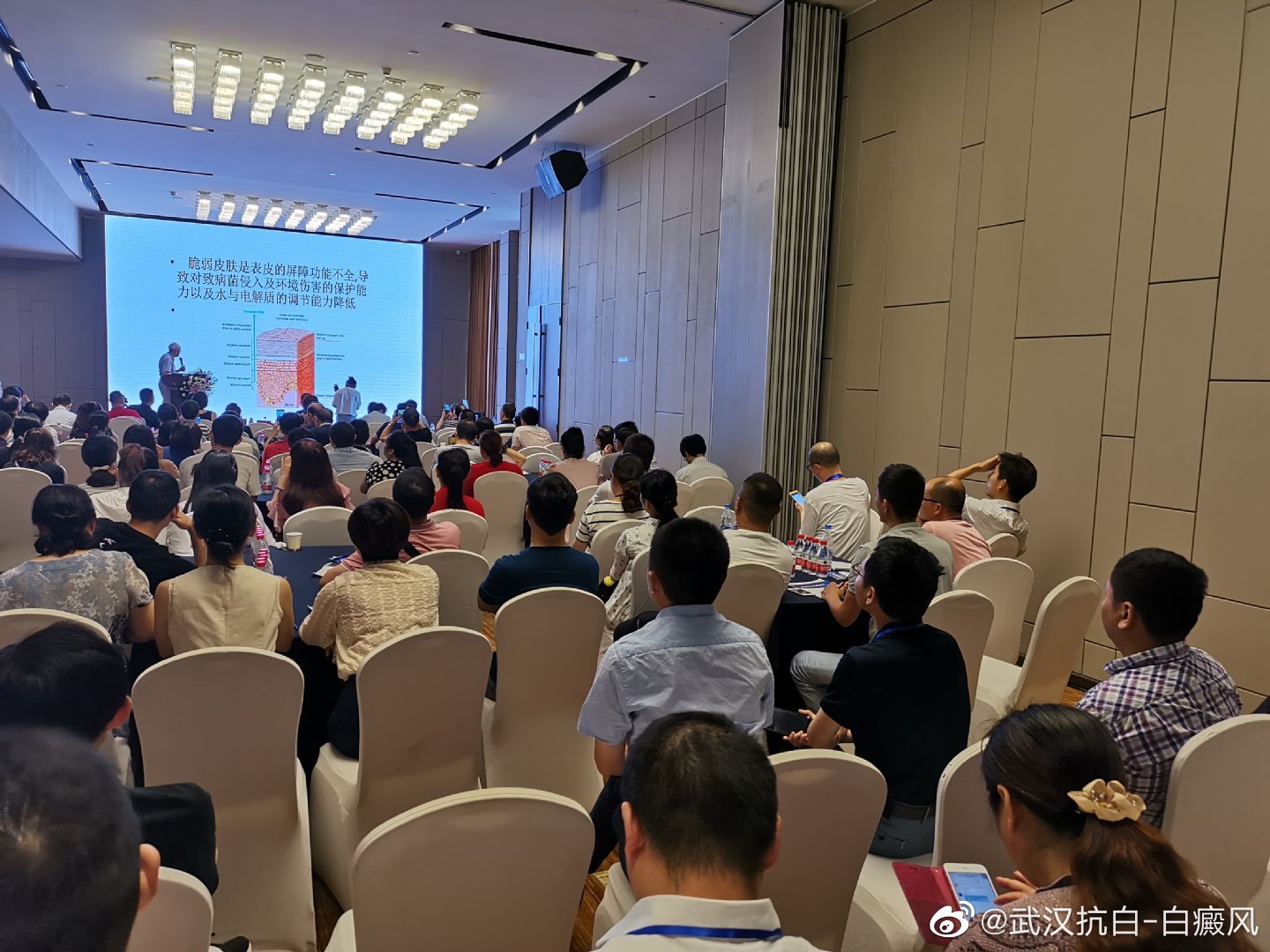 有几种方法可以治白癜风,这才是白癜风的最佳治疗方法