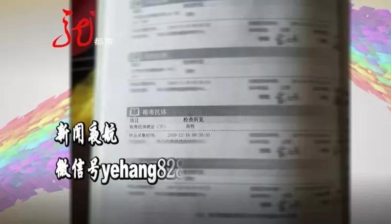 育婴师检测梅毒,孩子检查梅毒螺旋体抗体阳性