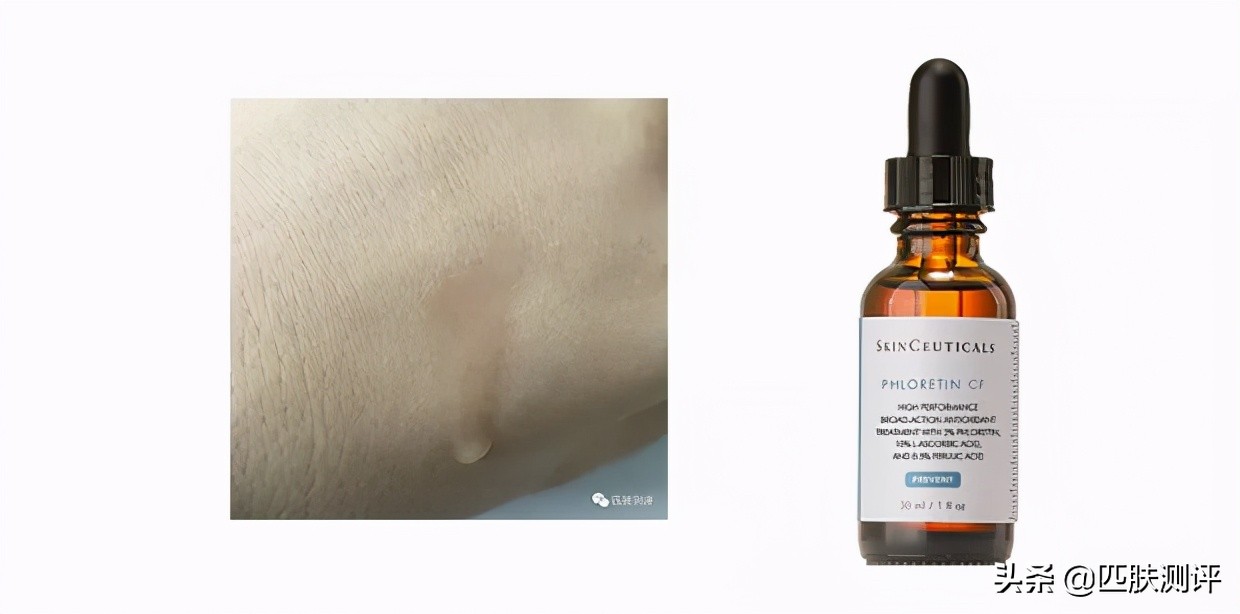 猛药美白产品,美白精华337怎么用