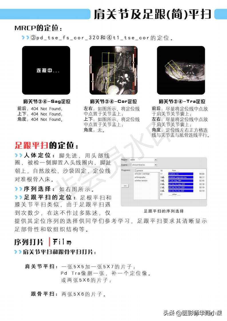 磁共振扫描技术西门子,西门子磁共振最新操作界面