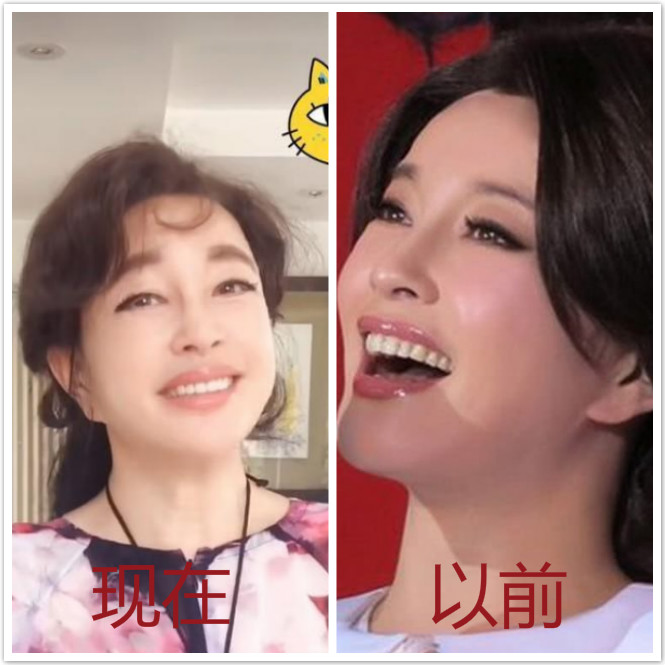 女明星整容脸垮了,容貌焦虑动刀整容案例