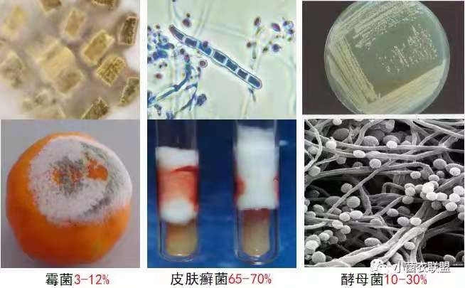 远离真菌感染,真菌性皮肤病的克星