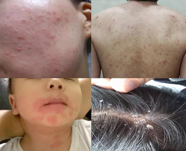 去被子上的螨虫的最佳方法,被子睡久了怎么除臭