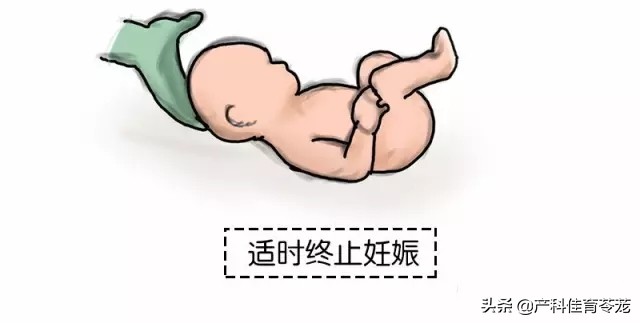 产科反思日记范文大全,产科医生之孕妇出血热