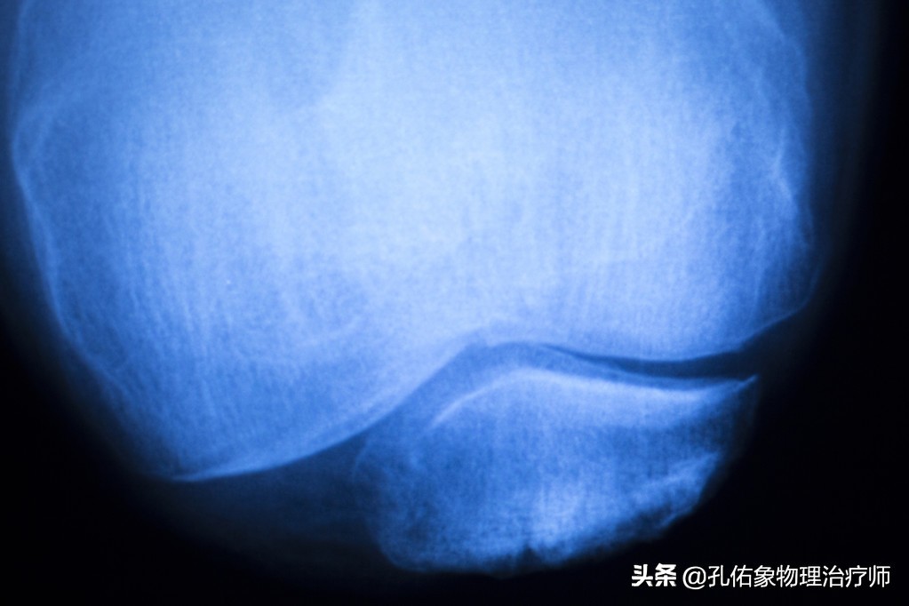 膝痛一招教你解决,膝痛怎样锻炼