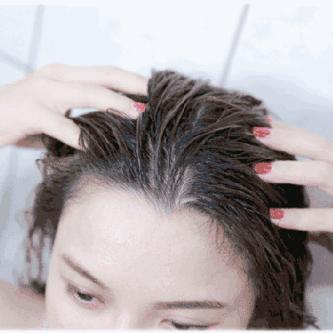 脱发联合治疗方案,脱发斑秃吃黄金搭档管用吗