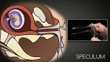 疤痕妊娠流产最好方法,各种流产方式总结