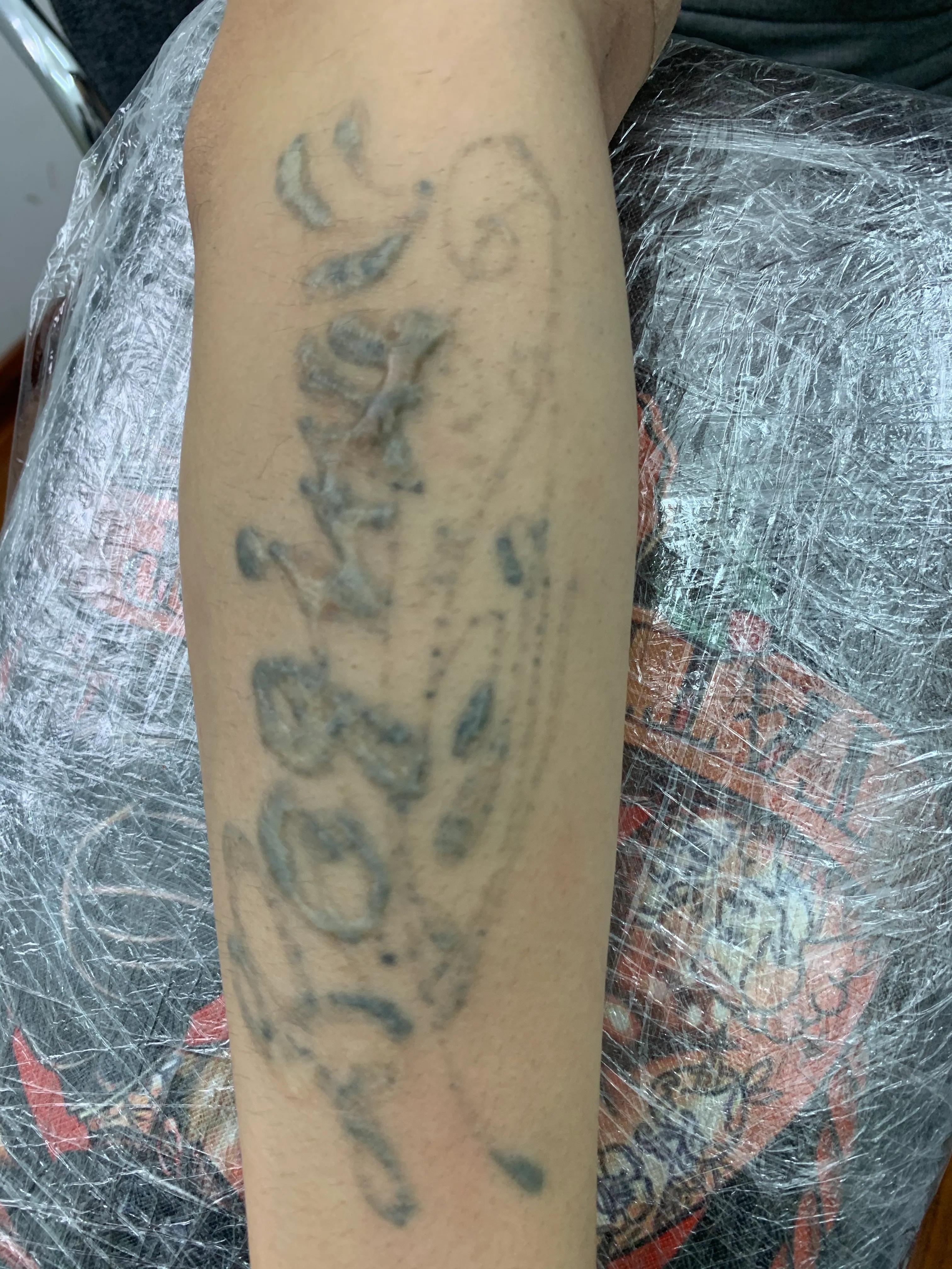 洗纹身能彻底洗掉吗豆瓣,纹身能彻底洗干净吗