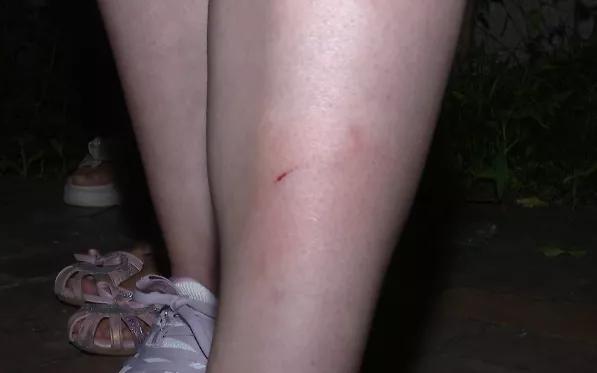 真是服了！高空抛物又来！贵州一女子小区散步，“钢琴”突然从天而降！结果......