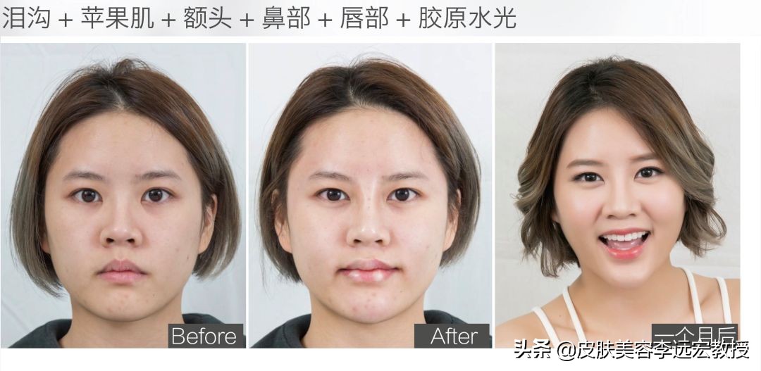 哪种口服胶原蛋白效果好,口服胶原蛋白的骗局