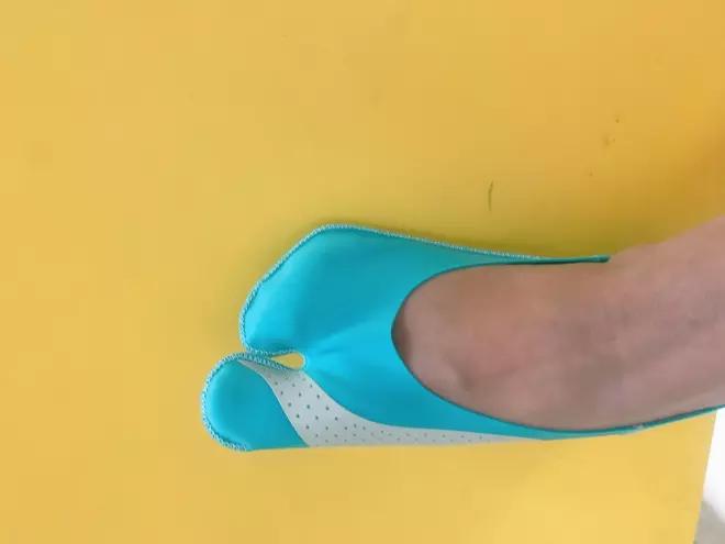 大脚趾拇指外翻矫正用多久,大脚拇指外翻导致第二脚趾弯曲