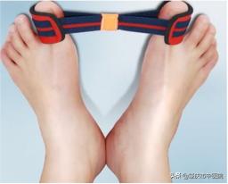 原来脚拇趾外翻是一种病，“元凶”竟是经常穿这种鞋有关！听听市中医院骨伤科专家怎么说……