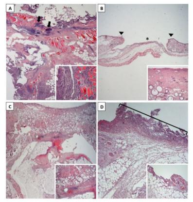 抗菌电纺百里酚负载聚己内酯垫的体内效应研究