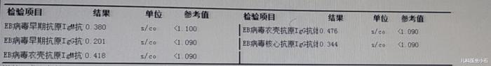 儿童eb病毒感染肝受损严重吗,EB病毒感染是什么