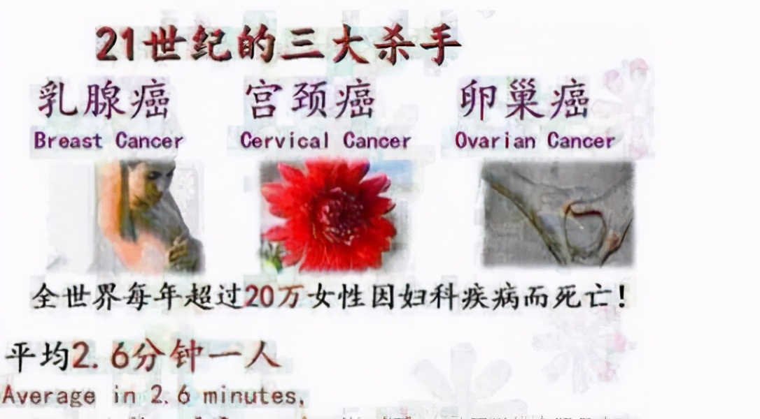 持续感染hpv18几年阳性tct正常,tct正常hpv18阳性到底用不用治