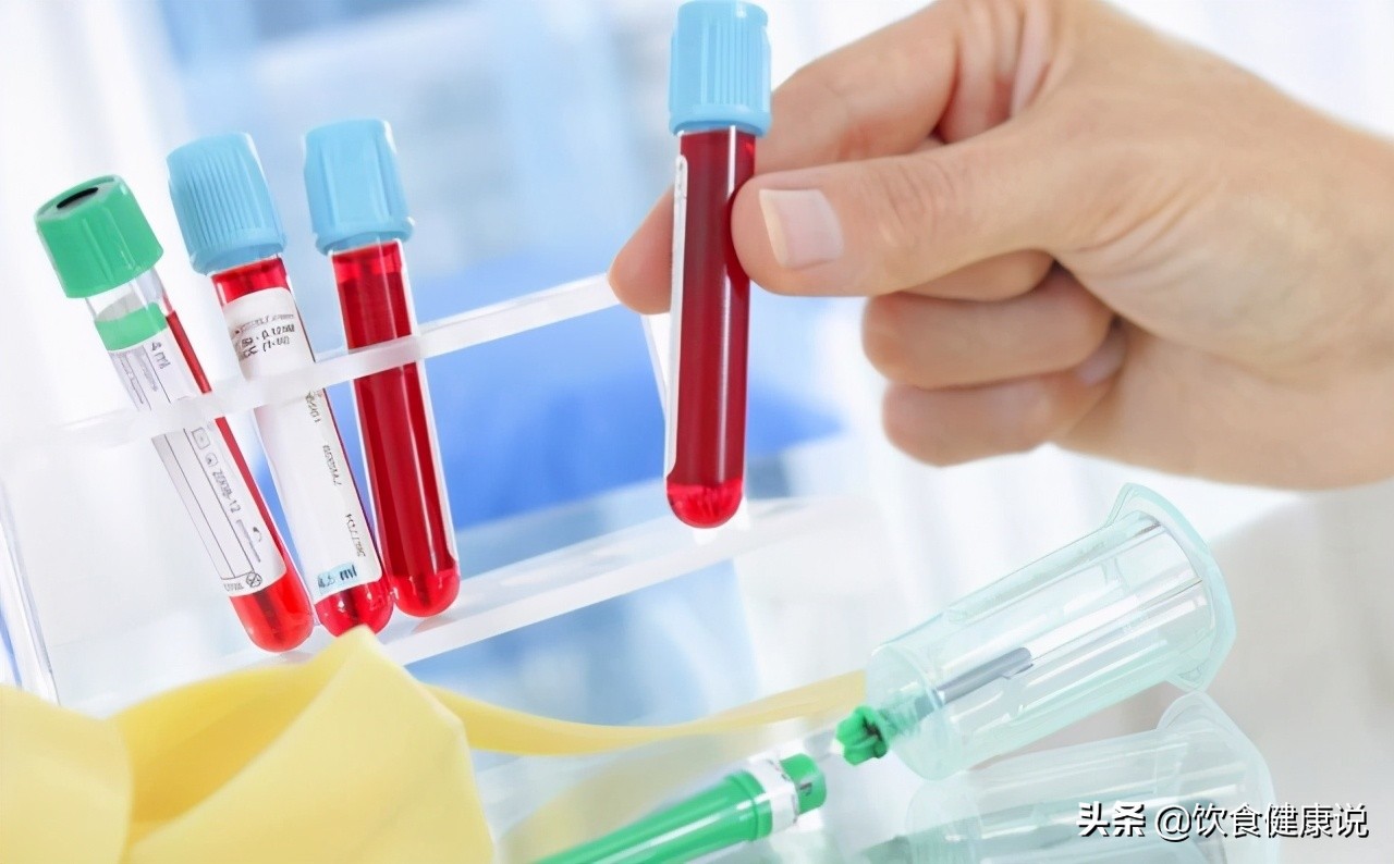 血常规检查有三个指标要注意,血常规检查主要看哪几项