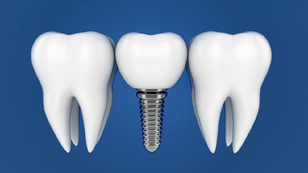 缺的牙齿长期不种牙会怎么样,牙病一直拖着不治会得什么病