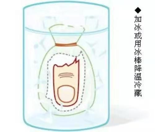 断指再植手术如何确认断指存活,断指再造多久后能下地走路