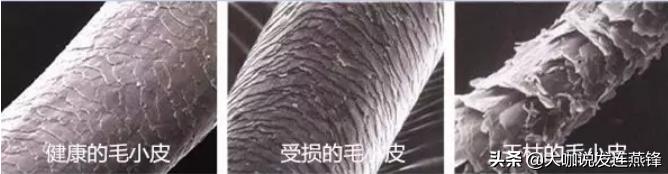 夏天紫外线强头发需要护理,头经常晒太阳脱发怎么预防