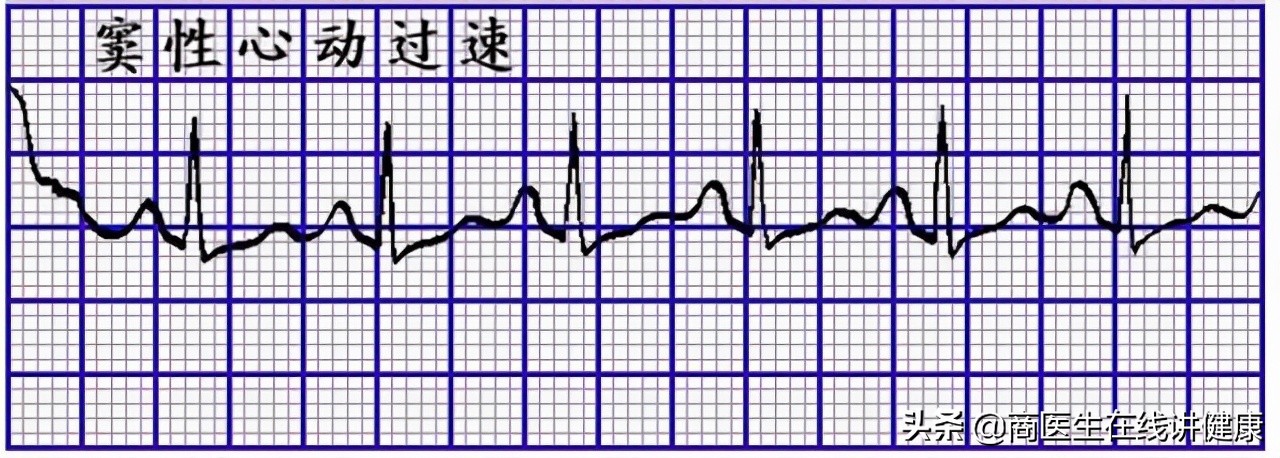心跳越慢越长寿减少剧烈运动,心跳越慢人会更长寿