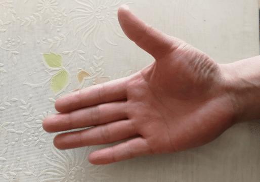 中年人患腱鞘炎怎么治,中老年腱鞘炎特效药