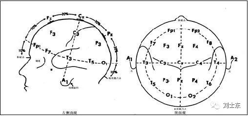 脑电图基础知识入门,脑电图基础知识讲解