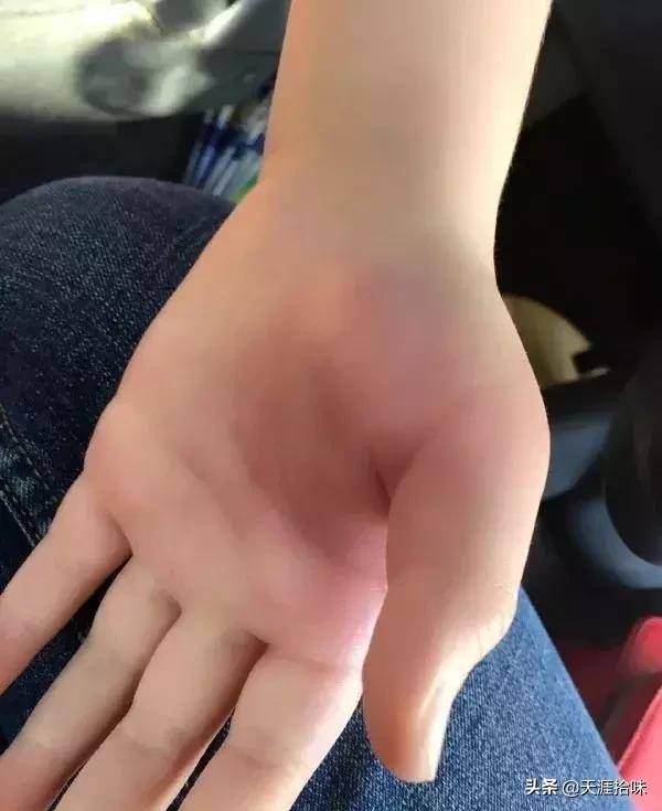 台风来了海岸上很多虫子,台风后出现的虫子