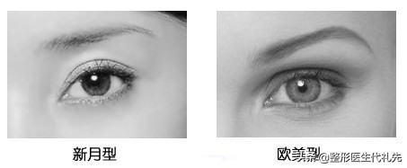 新月双眼皮怎样改扇形,聊双眼皮话术
