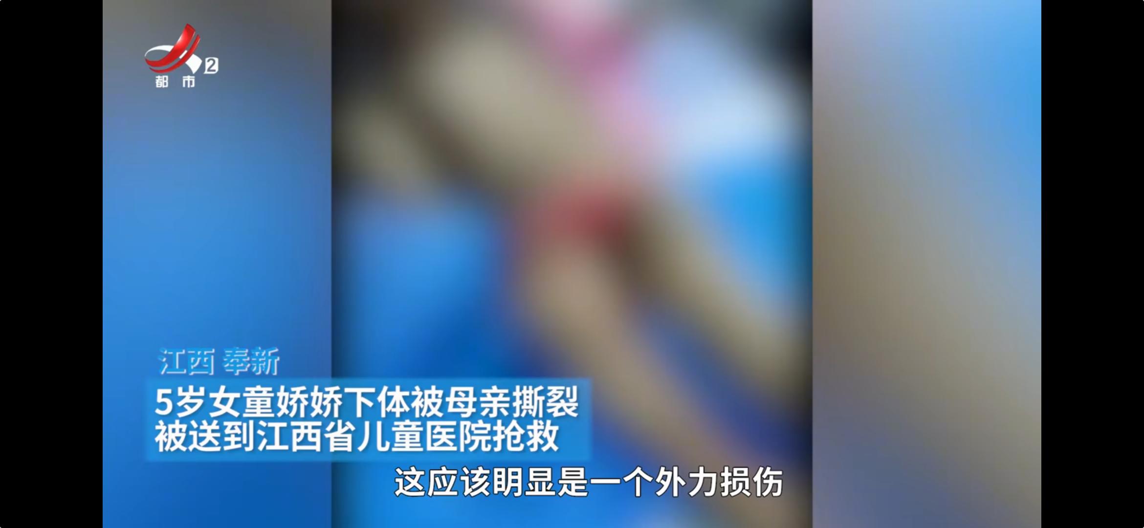 小孩子因为漏尿被妈妈打,6岁女童被亲妈打伤